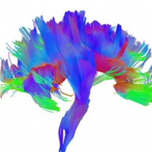 artistic rendering of brain stem